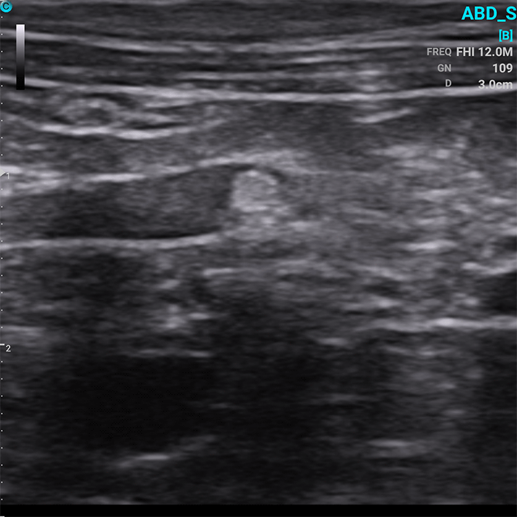 Chison SonoEye VET Handheld Mobile Phone Ultrasound | Veterinary Ultrasounds