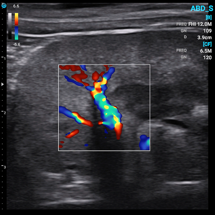 Chison SonoEye VET Handheld Mobile Phone Ultrasound | Veterinary Ultrasounds