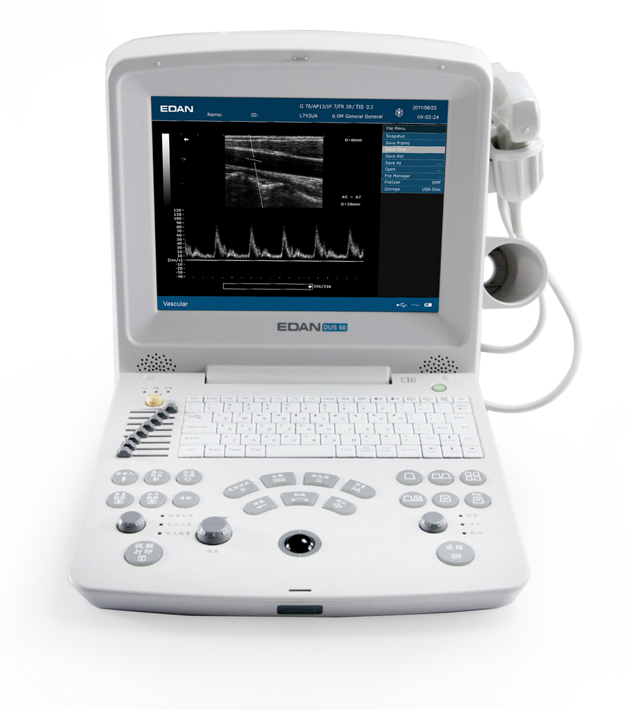 EDAN DUS 60 Black and White Ultrasound