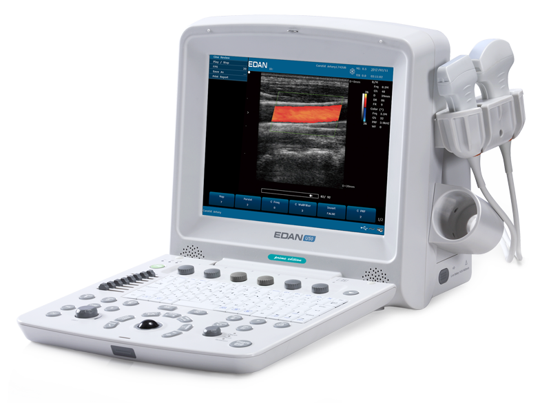 EDAN U50 Veterinary Ultrasound Model