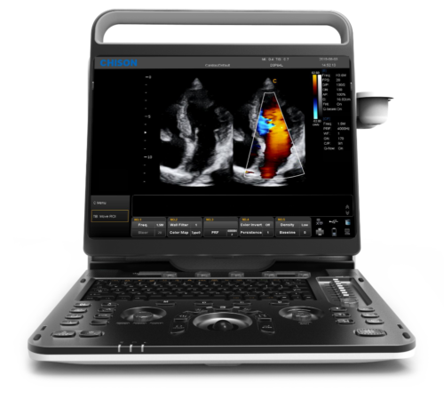 Chison EBit 60Vet | Veterinary Ultrasounds