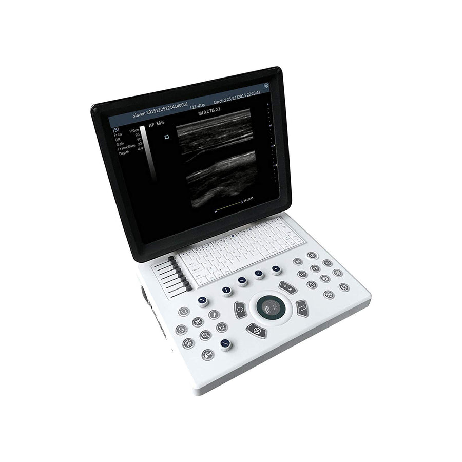 iuStar100Vet Black & White Laptop Ultrasound Machine For Veterinary