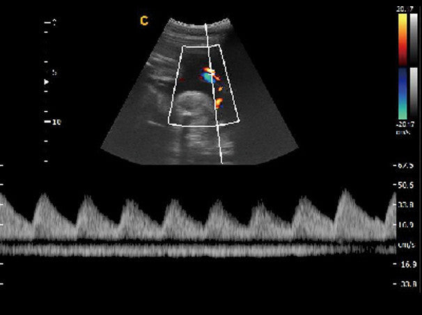 Chison Q9Vet Veterinary Ultrasounds