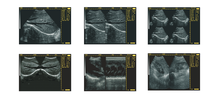 Used WED-3100V Ultrasound